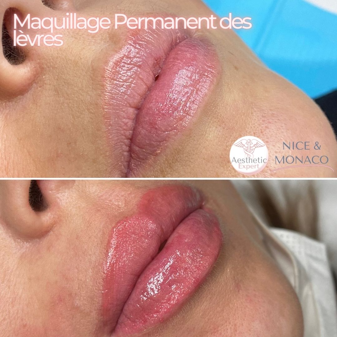maquillage-permanent-des-levres